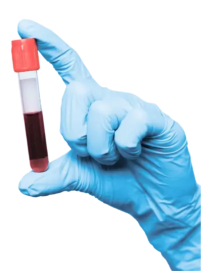 Лабораторні аналізи